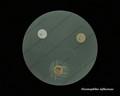 haemophilus influenzae